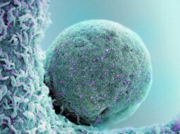 Oncology