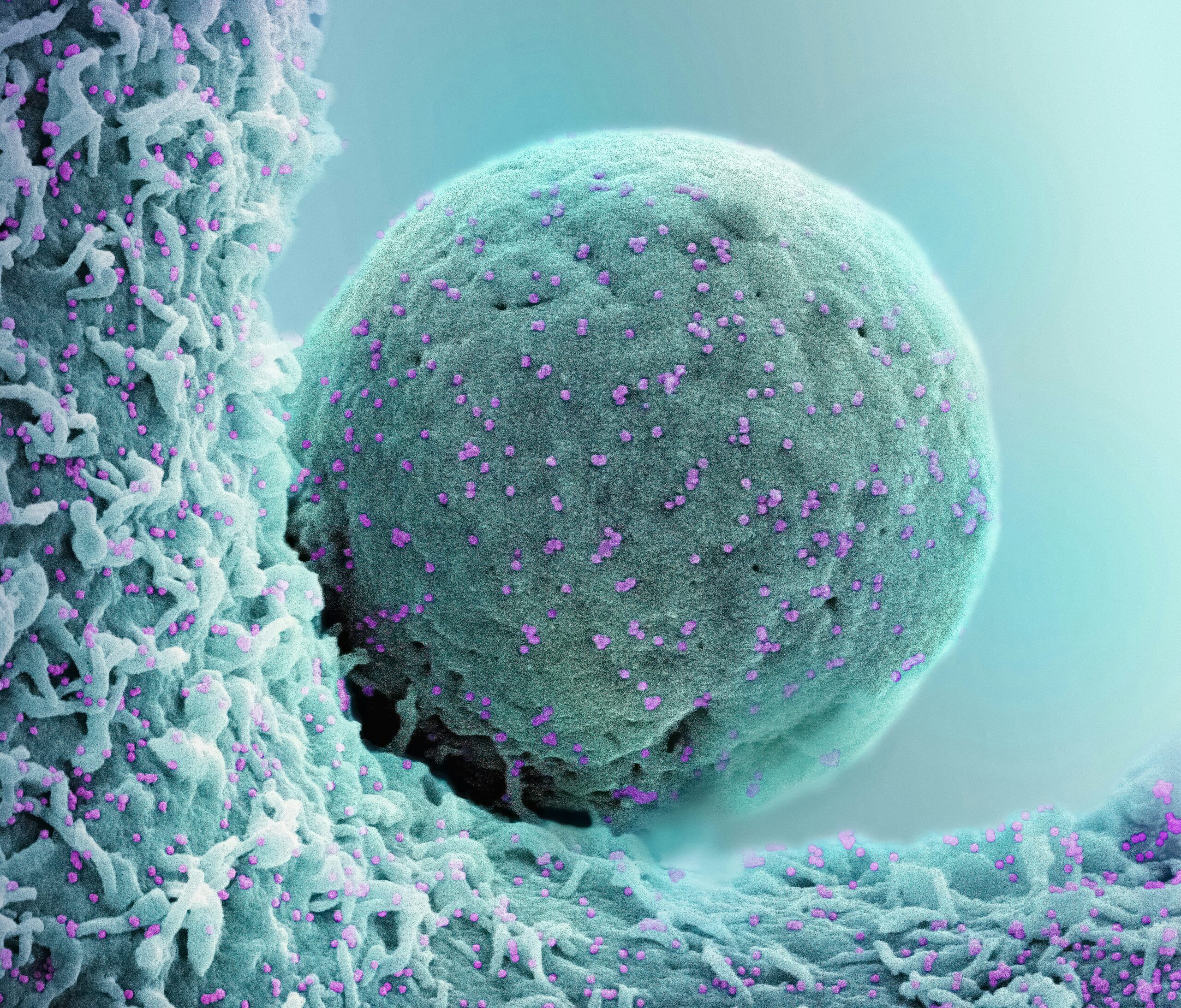 Oncology